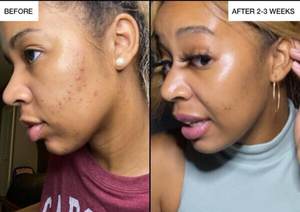 Productos para el cuidado de la piel de caramelo de etiqueta privada, suero facial antiacné que ilumina la piel negra, conjunto de cuidado de la piel con loción corporal, fabricantes - Product Image 5