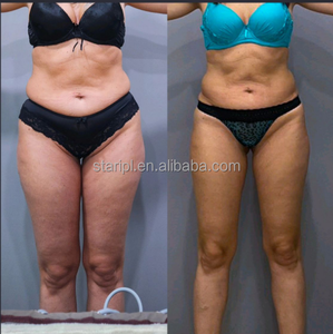 6D Lipo Laser therapie Gewichts verlust Fett verbrennung Lipolyse Schönheits salon Ausrüstung Fett absaugung Hauts kulptor Hauts traffung - Product Image 3