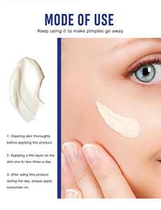 QBEKA Crema para el Tratamiento del Acné, Crema Facial para Marcas de Acné, Reduce los Poros, Hidrata la Piel - Product Image 5