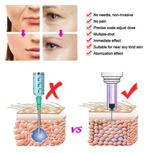 Penna per Iniezione Senza Ago per <span class=keywords><strong>Filler</strong></span> Labbra, Riempimento Dermico, Mesoterapia - Product Image 6