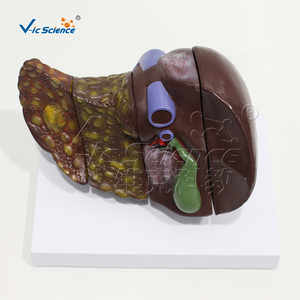 Modelo hepático doente (quatro estágios) hepatite crônica - Product Image 3