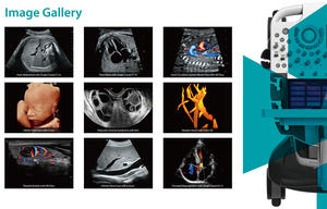 Diagnóstico asistido por IA Sonoscape P40 Elite Digital Color Doppler Ultrasonido Máquina 3D 4D Máquina De Ultrasonido para cardiología - Product Image 5