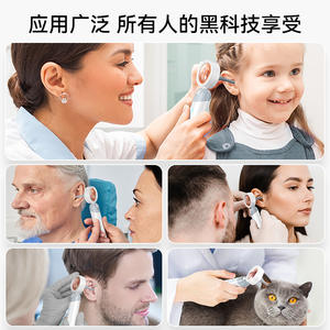 Otoscope lumineux le plus vendu pour une utilisation transfrontalière, équipement de diagnostic vétérinaire intelligent pour l'examen visuel de l'oreille, du nez et de la gorge - Product Image 4