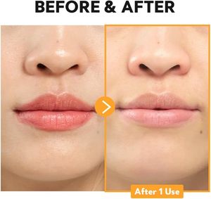 Kit Citron PHA & AHA : Poudre Nettoyante Exfoliante + Tonique à la Vitamine C – Exfoliation Douce & Hydratation pour Peaux Matures - Product Image 5