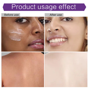 OEM/ODM Naturally Vegan Brighten Skin Best Glutathione Lightening Knuckle Black Spot Blanqueamiento Loción corporal para hombres y mujeres - Product Image 2