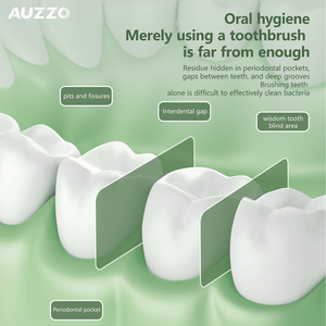 Mini hilo dental de agua de viaje portátil, limpiador de dientes inalámbrico inteligente, irrigador Oral recargable, cuidado Dental impermeable con punta de chorro - Product Image 6