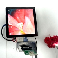 Endoscope d'imagerie dentaire à écran tactile HD Module de caméra E35 avec capture d'image