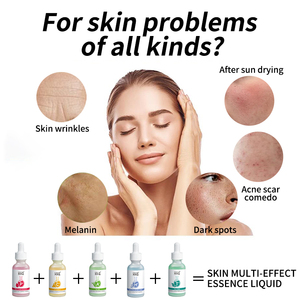 Bán buôn OEM hiệu quả cao làm trắng sáng tại chỗ-mờ dần cho da xỉn vitamin C làm trắng bản chất - Product Image 4