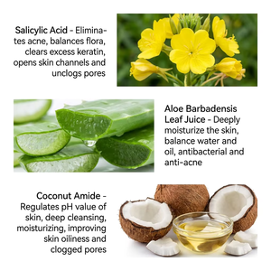 Jabón de Ácido Salicílico <span class=keywords><strong>para</strong></span> el Tratamiento del Acné y las Espinillas, Exfoliante Facial y Corporal, Se Puede Personalizar <span class=keywords><strong>con</strong></span> Serigrafía - Product Image 4