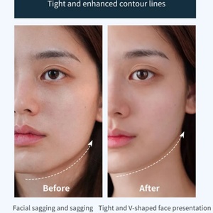 Home Use Mini <b>Electric</b> Face Massage and Neck Rejuvenation Facial Massager <b>Instrument</b> - Product Image 6