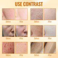Appareil de beauté NIR+ à double poignée, 1200W, refroidissement saphir -10°C, pour rajeunissement cutané et élimination des pigments et des taches vasculaires, version AU