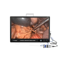 Système de caméra endoscopique électrique tout-en-un IKEDA YKD-9127 ENT 27 pouces 4K 2160P avec source de lumière médicale, laparoscope certifié CE