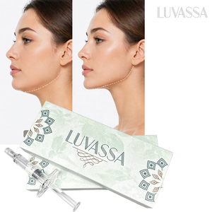 Wholesale <strong>Price</strong> Luvassa 1.1ml <strong>Hyaluronic</strong> <strong>Acid</strong> Filler for Facial Lips Cheek Jawline Neck Subtle Volume Enhancement - Product Image 3