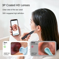 Endoscope auriculaire numérique HD avec caméra pour inspection du cérumen et cure-oreille, Modèle V21, éclairage LED, portable, magique