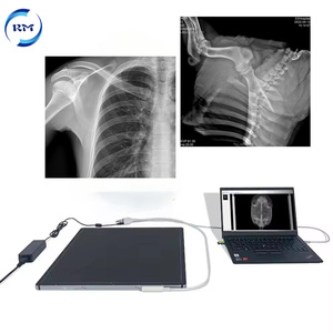 Detector de Panel Plano de Rayos X Digital Inalámbrico con Software de Imagenología para Hospital Veterinario Eléctrico 1417/1717 FPD - Product Image 4