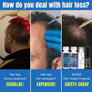 Nuevo diseño rogain Kit de espuma para el crecimiento del cabello 5% Romero menta cuero cabelludo Rogane espuma para el cabello biotina tratamientos para la pérdida de cabello para hombres y mujeres - Product Image 5