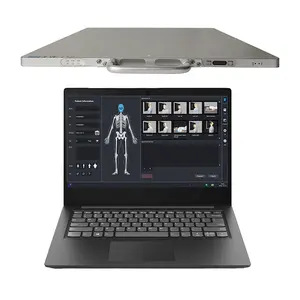 17*17 <span class=keywords><strong>Dr</strong></span> detektor Panel datar <span class=keywords><strong>x</strong></span>-<span class=keywords><strong>ray</strong></span> <span class=keywords><strong>Digital</strong></span> nirkabel dokter hewan dengan gambar luar biasa - Product Image 1