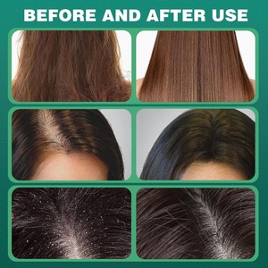 Usman Cỏ Cây Bách lá tam giác dầu gội và điều hòa xà phòng chống gàu handmade rắn tóc xà phòng - Product Image 2