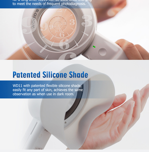 시그마 <span class=keywords><strong>SW</strong></span>-11 휴대용 디지털 피부경 검사기 피부 진단용 - Product Image 5