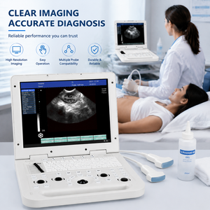 Escáner <span class=keywords><strong>de</strong></span> <span class=keywords><strong>Ultrasonido</strong></span> Portátil, Completamente Digital, en Blanco y Negro, para Diagnóstico Clínico <span class=keywords><strong>Abdominal</strong></span>, Obstetricia y Ginecología Humana - Product Image 1