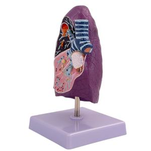 Modelo de pulmón patológico para fines de enseñanza médica - Product Image 3
