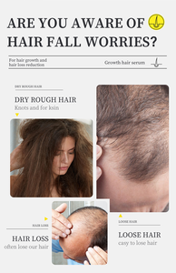 Champú Anticaída con ADN y <span class=keywords><strong>Glicerina</strong></span> de Sodio, Natural a Base de Hierbas para el Crecimiento del Cabello, Fortalece las Raíces, Controla la Grasa y Anticaspa, 30ml - Product Image 3