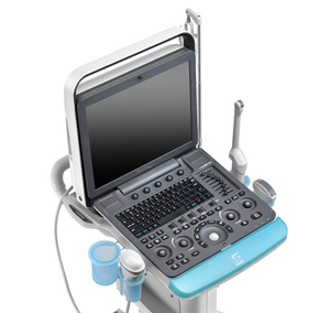 Ecógrafo Veterinario Portátil Sonoscape S8expV, Ecocardiografía, Ecógrafo Doppler Color 3D 4D con 2 Sondas - Product Image 2