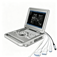 Escáner de Ultrasonido Portátil para Diagnóstico de Embarazo en Animales, Máquina de Ultrasonido Veterinaria con Sondas para Clínica