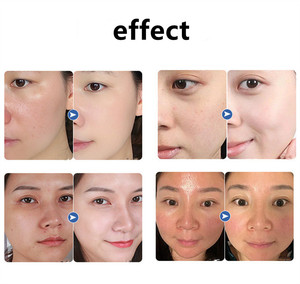 Zs Đồng Peptide Booster Hyaluronic Axit Dưỡng Ẩm Làm Trắng Da Chống Oxy Chống Oxy Chống Oxy Phát Sáng Giải Pháp Aqua Máy Bay Phản Lực Vỏ Phun Huyết Thanh - Product Image 6