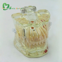 Modelo de Dientes para Patología, Modelo de Estudio Dental