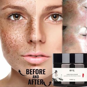 Meilleure vente Blanchiment de la peau Taches de rousseur Supprimer les boutons Acné Taches pigmentaires foncées Crème rapide <span class=keywords><strong>pour</strong></span> le visage <span class=keywords><strong>pour</strong></span> hommes et femmes - Product Image 4
