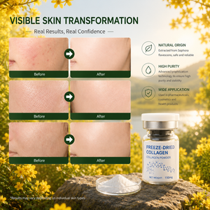 Colágeno 150mg Liofilizado, Ingrediente Cosmético de Alta Pureza - Product Image 4