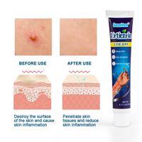 Sumifun Urticaire Huile pour traiter les maladies de la peau Eczéma Dermatite Psoriasis Pommade bactérienne Anti Démangeaisons Soins du plâtre médical