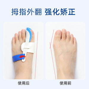 Attelle de Correction d'Orteils en PVC Blanc Réglable pour le Soin des Pieds et le Soulagement du Hallux Valgus - Product Image 2