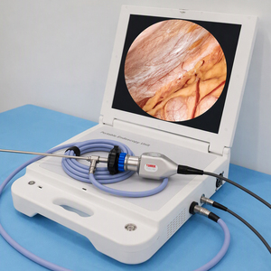 Système de caméra endoscopique médicale portable Full HD pour laparoscopie, hystéroscopie, ORL et chirurgie laparoscopique - Product Image 1