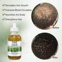 Élixir Tonique Capillaire Anti-Chute OEM Huile de Romarin Croissance des Cheveux Mélange Herbal Ricin Menthe Poivrée