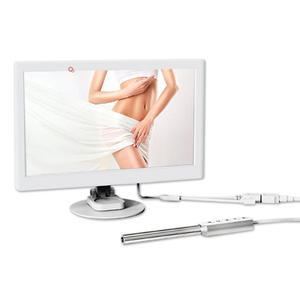 Système de caméra endoscopique sans fil portable à la maison Caméra endoscopique HD Examen endoscopique vaginal - Product Image 6