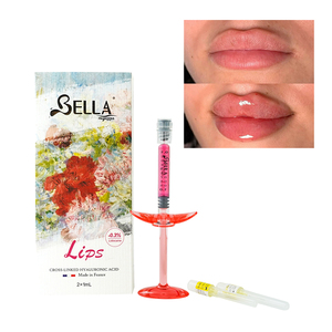 Gel Inyectable <span class=keywords><strong>de</strong></span> Ácido Hialurónico Reticulado Premium para <span class=keywords><strong>Aumento</strong></span> <span class=keywords><strong>de</strong></span> <span class=keywords><strong>Labios</strong></span>, Proveedor Mayorista <span class=keywords><strong>de</strong></span> Fábrica OEM - Product Image 3
