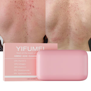 สบู่วีแกนธรรมชาติ 5 in 1 สำหรับสิวหลัง แบรนด์ส่วนตัว ผลิตภัณฑ์ความงาม ช่วยให้ผิวขาวกระจ่างใส ลดเลือนจุดด่างดำ สบู่ทำมือสำหรับผิวกายและผิวหน้า - Product Image 1