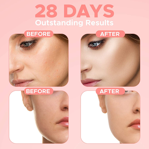 Suero Facial 4 <span class=keywords><strong>en</strong></span> 1 al por Mayor, Cuidado de la Piel Coreano, Hidratante, Iluminador, con Ácido Hialurónico, Niacinamida, Vitaminas C y E, Refrescante - Product Image 2