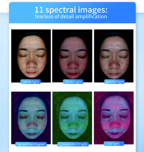 Analizador de Piel y Cuero Cabelludo 3D con IA X5Pro - Sistema de Detección Inteligente de 36 Millones de Píxeles para Análisis de Problemas Faciales y del Cuero Cabelludo - Product Image 6