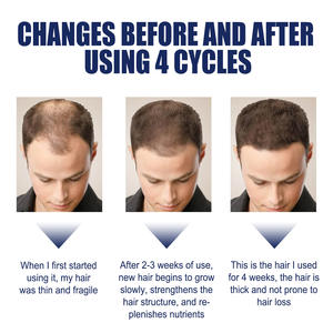 Vente directe d'usine OEM Facile à utiliser <span class=keywords><strong>Symptômes</strong></span> de perte de cheveux améliorant l'huile essentielle de cheveux de plantes naturelles - Product Image 4