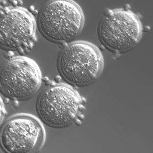 Microscopio de Contraste con Modulación Hoffman MF53-PMC para aplicaciones de asistencia reproductiva IVF - Product Image 4