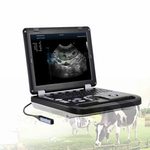 G-803 उच्चतम लागत प्रभावी 3 डी 4 डी 5 डी पूर्ण डिजिटल वेट कलर डॉपलर ट्रॉली अल्ट्रासाउंड मशीन - Product Image 1