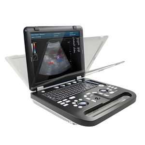Peralatan sonografi medis sistem Ultrasound kompak dengan probe Array Linear, cembung, dan sewa - Product Image 2