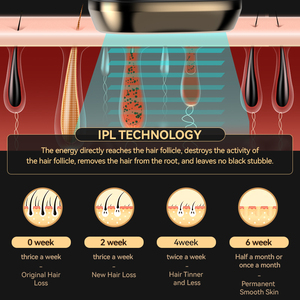 Étiquette personnalisée pour appareil d'épilation IPL, machine d'épilation <span class=keywords><strong>laser</strong></span> permanente à refroidissement par glace, <span class=keywords><strong>prix</strong></span> - Product Image 2