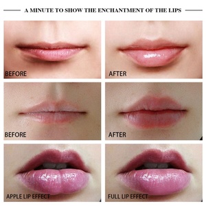 Dispositivo Eléctrico para Aumentar el Volumen de Labios, Herramienta de Belleza para Uso Doméstico, Silicona para Labios Más Grandes y Sexys - Product Image 6