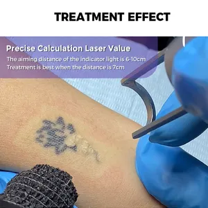 2023 O mais novo portátil pico laser picosegundo laser toda a remoção do melasma do pigmento e remoção da tatuagem 755nm picosegundo