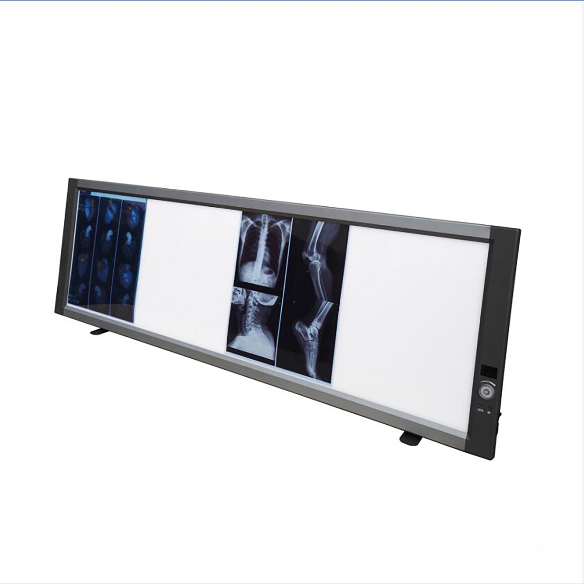 Visor de películas de rayos X LED médico ajustable Cuádruple visión de caja de visualización de películas de rayos X