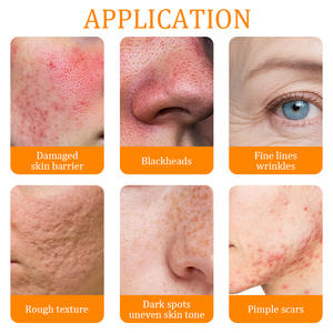 חומצה אסקורבית 3-אתיל (CAS 86404-04-8) 99%  אבקה קוסמטית - Product Image 5